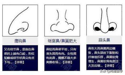 鼻面相|鼻相分析10款｜鼻樑有節及橫紋、豬膽鼻、鼻頭下垂代表甚麼？姻 